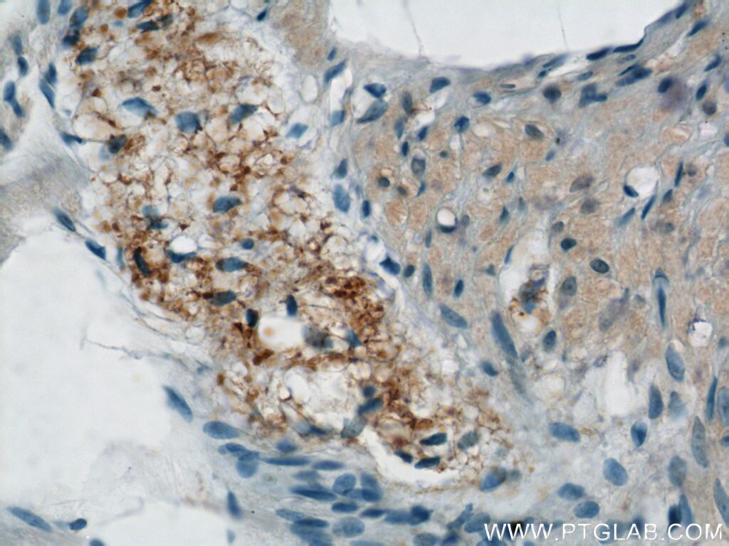 Immunohistochemistry (IHC) staining of human small intestine tissue using NMU Polyclonal antibody (24862-1-AP)