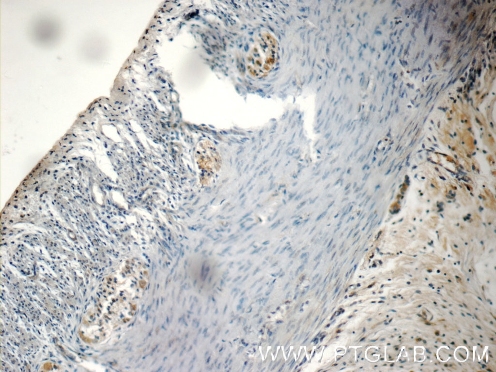 Immunohistochemistry (IHC) staining of human colon tissue using NMU Polyclonal antibody (24862-1-AP)