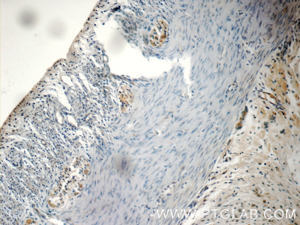 IHC staining of human colon using 24862-1-AP