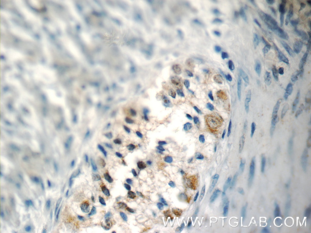 Immunohistochemistry (IHC) staining of human colon tissue using NMU Polyclonal antibody (24862-1-AP)