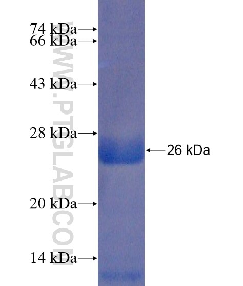 NMU fusion protein Ag21516 SDS-PAGE
