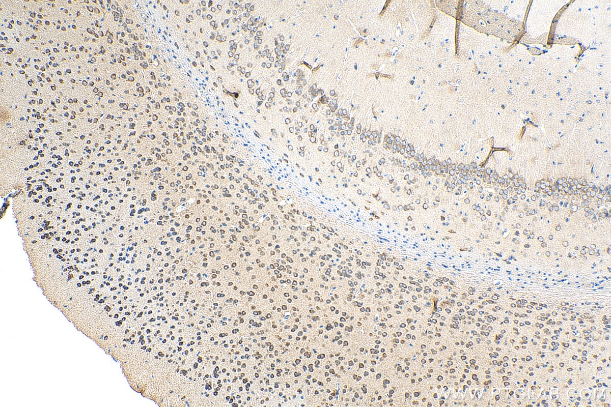 IHC staining of mouse brain using 14619-1-AP