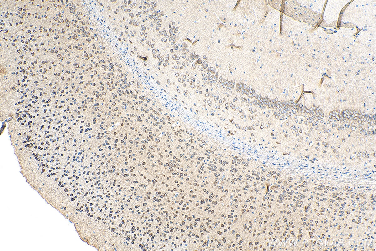 Immunohistochemistry (IHC) staining of mouse brain tissue using NMUR1 Polyclonal antibody (14619-1-AP)