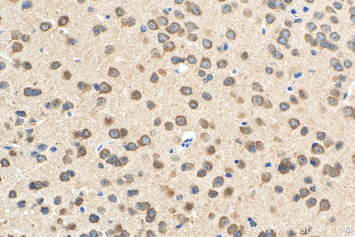 Immunohistochemistry (IHC) staining of mouse brain tissue using NMUR1 Polyclonal antibody (14619-1-AP)