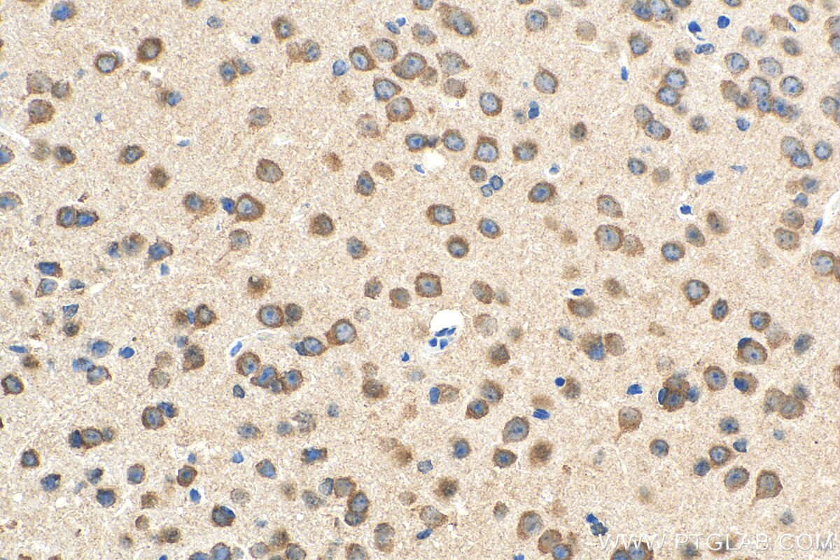 IHC staining of mouse brain using 14619-1-AP