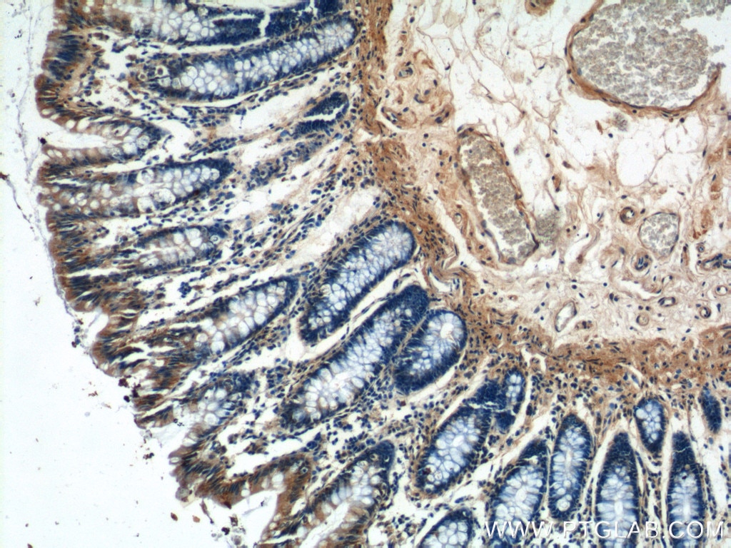 Immunohistochemistry (IHC) staining of human colon tissue using NMUR1 Polyclonal antibody (14619-1-AP)