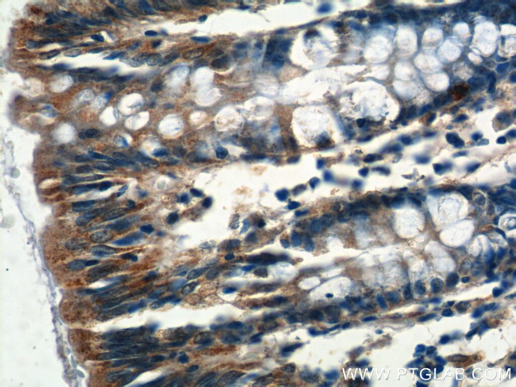 Immunohistochemistry (IHC) staining of human colon tissue using NMUR1 Polyclonal antibody (14619-1-AP)