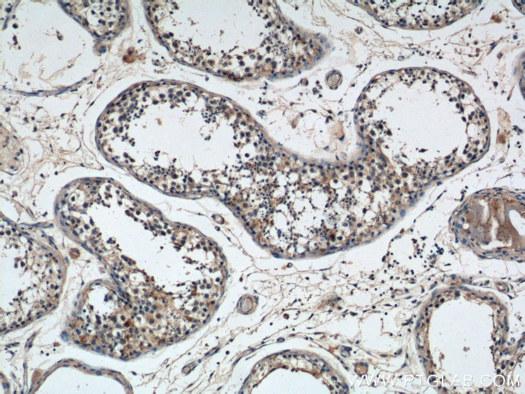 Immunohistochemistry (IHC) staining of human testis tissue using NMUR1 Polyclonal antibody (14619-1-AP)
