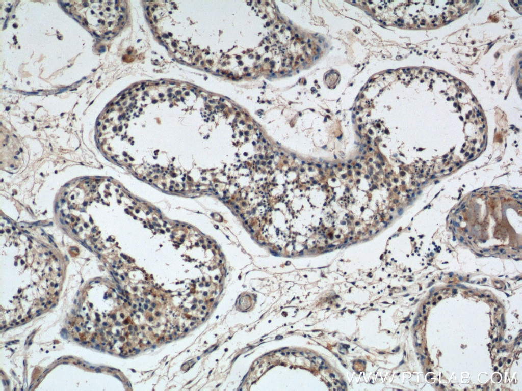 IHC staining of human testis using 14619-1-AP