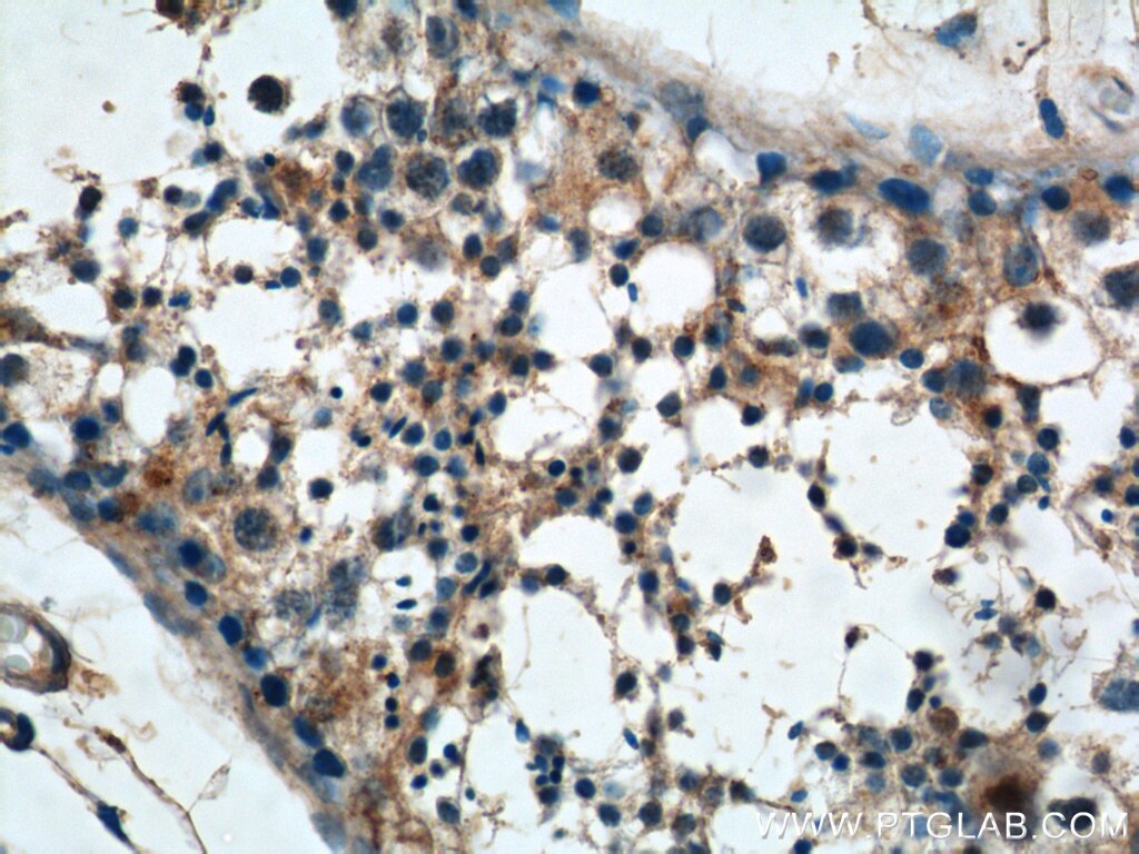 IHC staining of human testis using 14619-1-AP