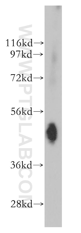 Western Blot (WB) analysis of mouse pancreas tissue using NMUR1 Polyclonal antibody (14619-1-AP)