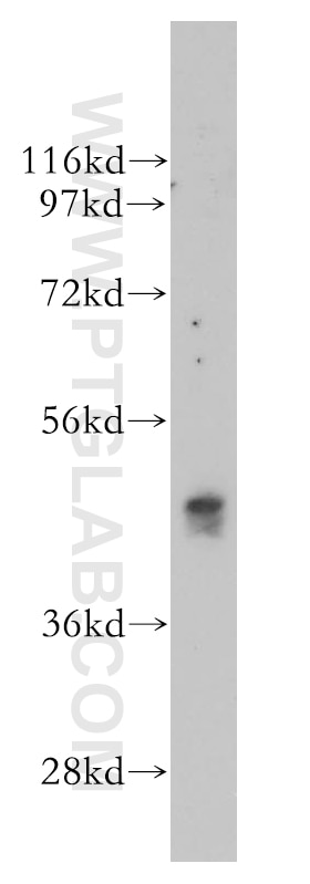 Western Blot (WB) analysis of human stomach tissue using NMUR1 Polyclonal antibody (14619-1-AP)