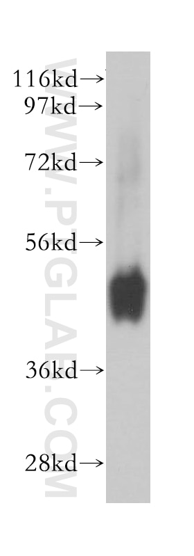 Western Blot (WB) analysis of human colon tissue using NMUR1 Polyclonal antibody (14619-1-AP)