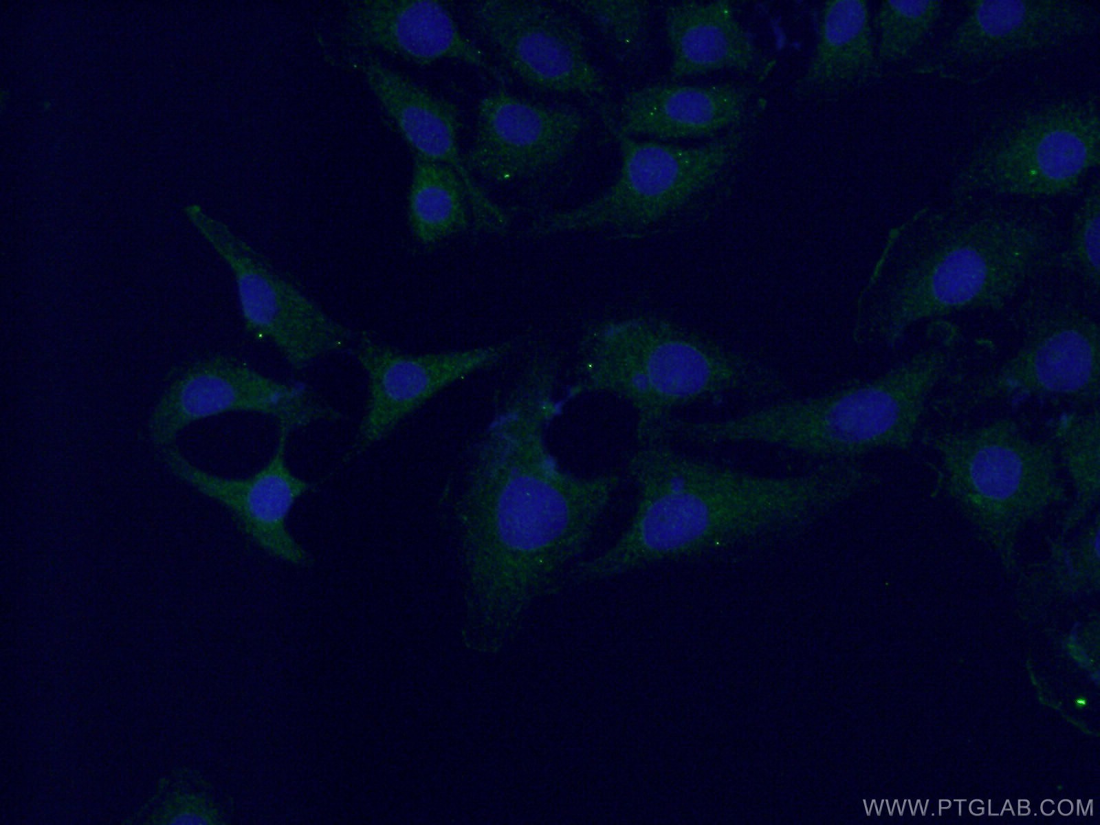 Immunofluorescence (IF) / fluorescent staining of SH-SY5Y cells using Neuronatin Polyclonal antibody (26905-1-AP)