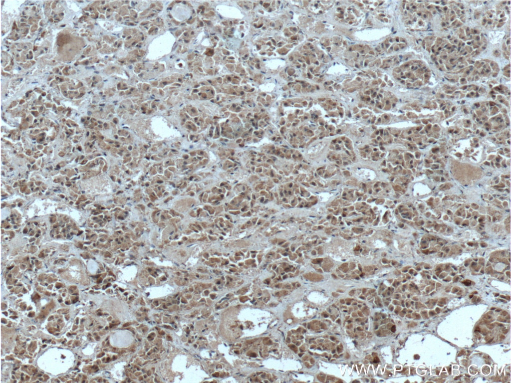 Immunohistochemistry (IHC) staining of human pituitary tissue using Neuronatin Polyclonal antibody (26905-1-AP)