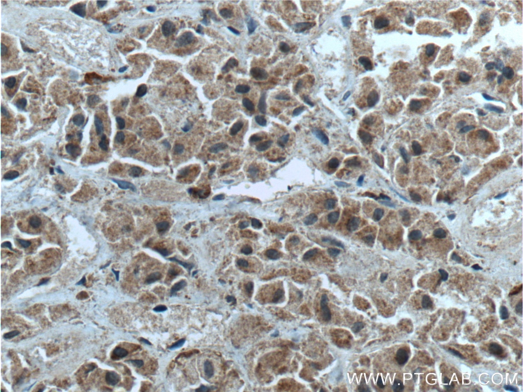 Immunohistochemistry (IHC) staining of human pituitary tissue using Neuronatin Polyclonal antibody (26905-1-AP)
