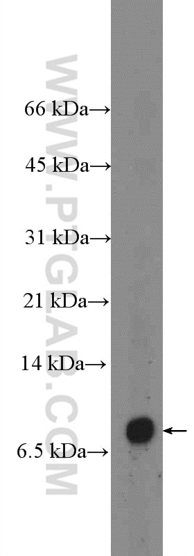 Western Blot (WB) analysis of fetal human brain tissue using Neuronatin Polyclonal antibody (26905-1-AP)