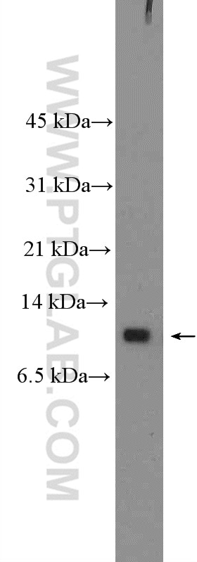 Western Blot (WB) analysis of SH-SY5Y cells using Neuronatin Polyclonal antibody (26905-1-AP)