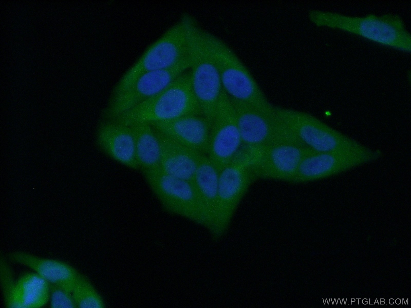Immunofluorescence (IF) / fluorescent staining of HepG2 cells using NNMT Polyclonal antibody (15123-1-AP)