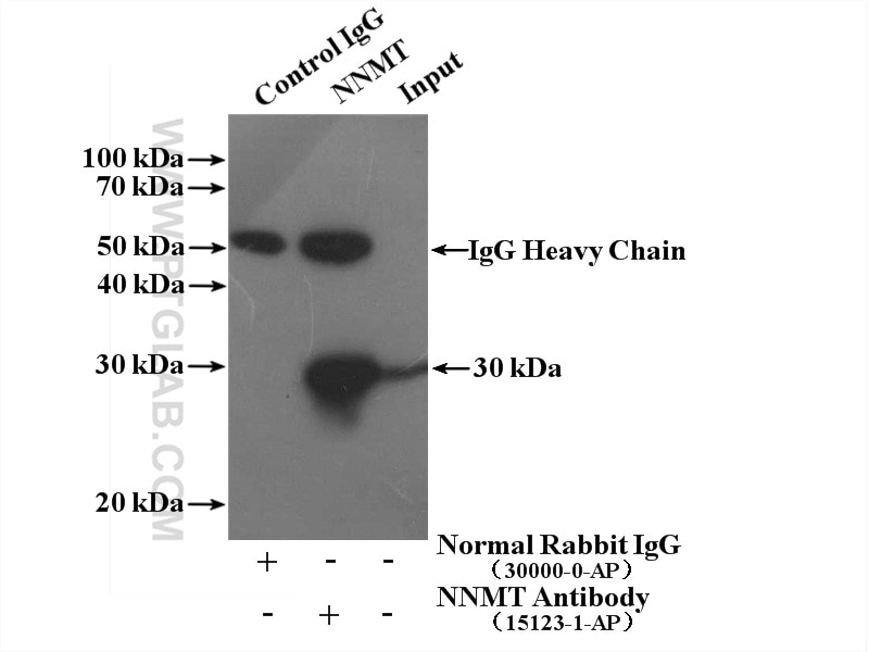 Immunoprecipitation (IP) experiment of HepG2 cells using NNMT Polyclonal antibody (15123-1-AP)