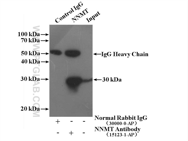 IP experiment of HepG2 using 15123-1-AP