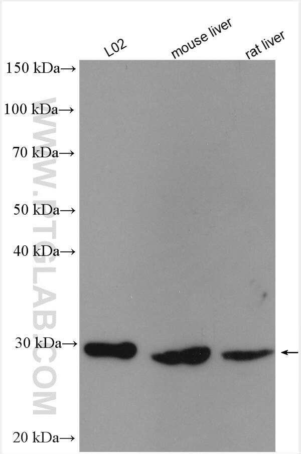 Western Blot (WB) analysis of various lysates using NNMT Polyclonal antibody (15123-1-AP)