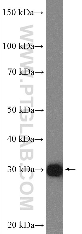 Western Blot (WB) analysis of HepG2 cells using NNMT Polyclonal antibody (15123-1-AP)