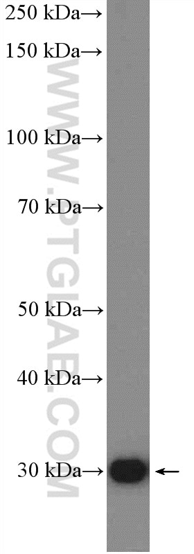 Western Blot (WB) analysis of L02 cells using NNMT Polyclonal antibody (15123-1-AP)