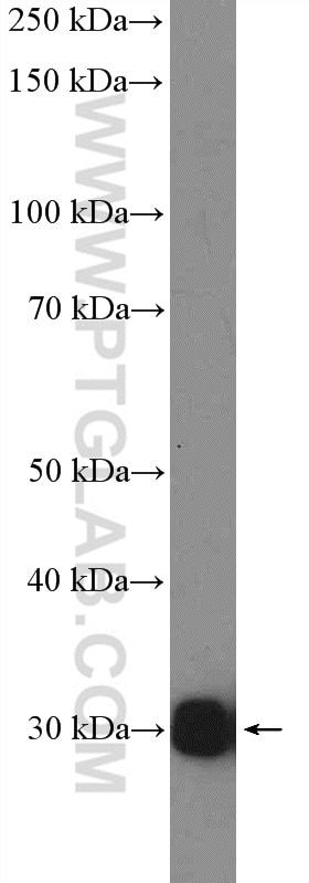 Western Blot (WB) analysis of mouse liver tissue using NNMT Polyclonal antibody (15123-1-AP)