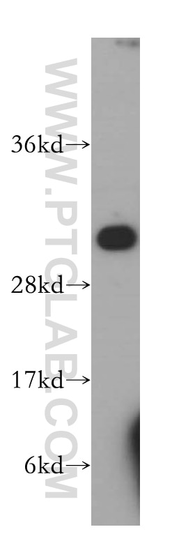Western Blot (WB) analysis of HepG2 cells using NNMT Polyclonal antibody (15123-1-AP)