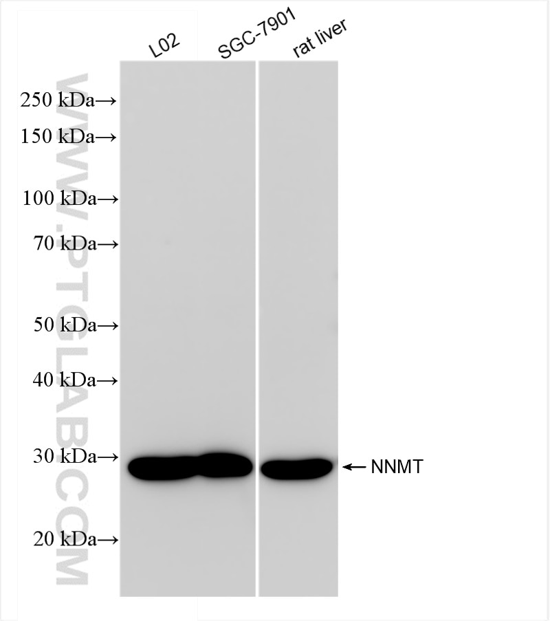 Western Blot (WB) analysis of various lysates using NNMT Recombinant antibody (84876-5-RR)