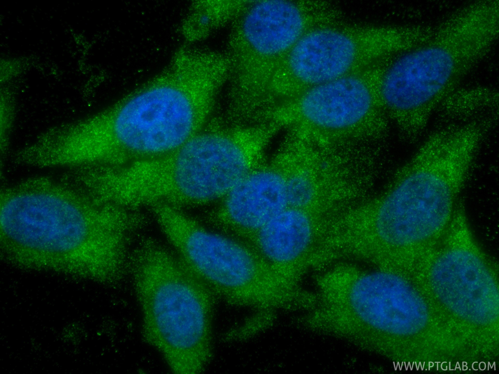 Immunofluorescence (IF) / fluorescent staining of HepG2 cells using NNMT Recombinant monoclonal antibody (84876-9-RR)