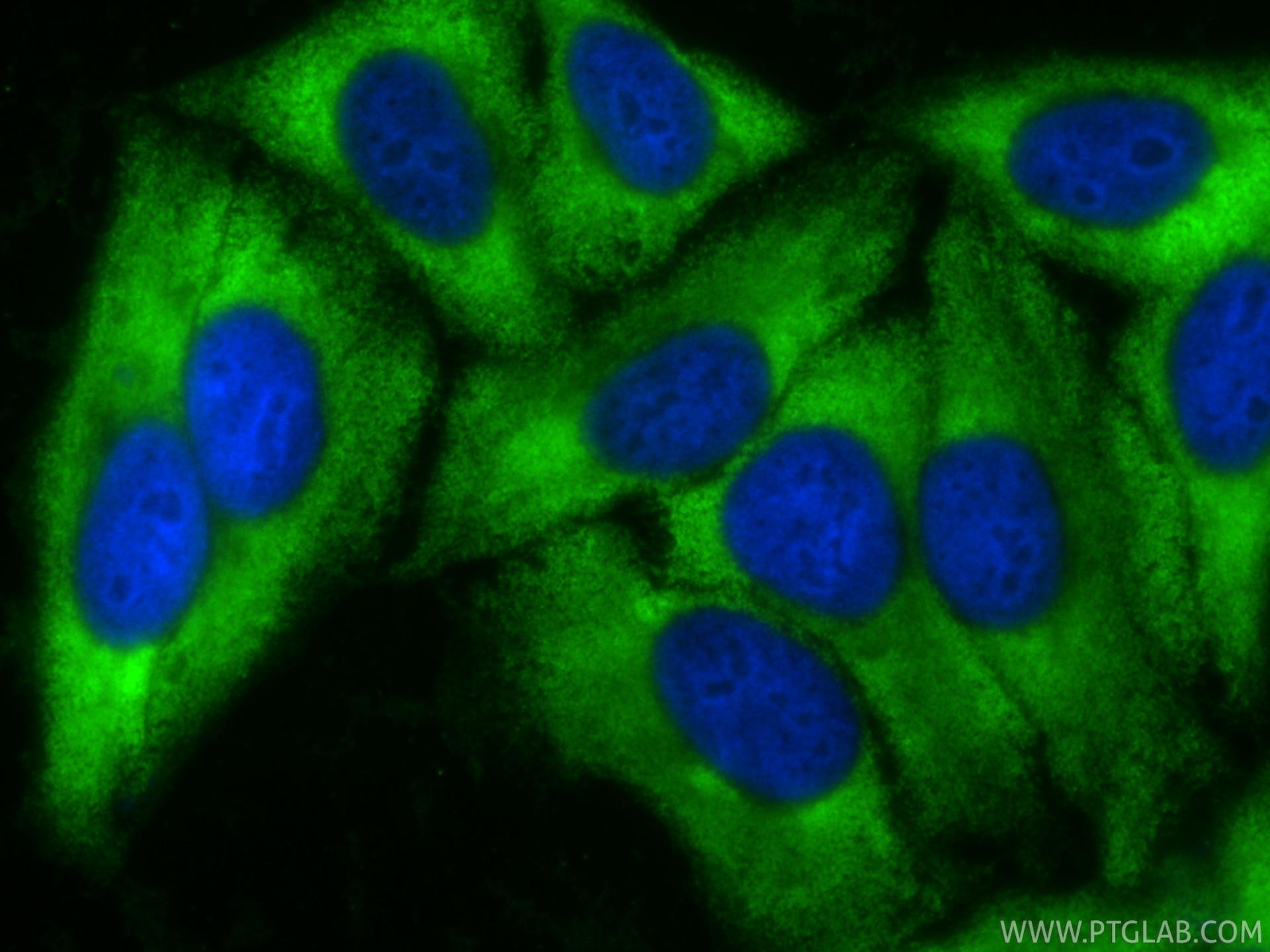 IF Staining of HepG2 using CL488-84876-9 Immunofluorescence (IF) / fluorescent staining of HepG2 cells using CoraLite® Plus 488-conjugated NNMT Recombinant mon (CL488-84876-9)