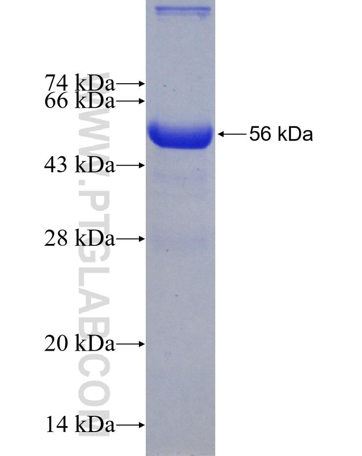 NNMT fusion protein Ag7197 SDS-PAGE