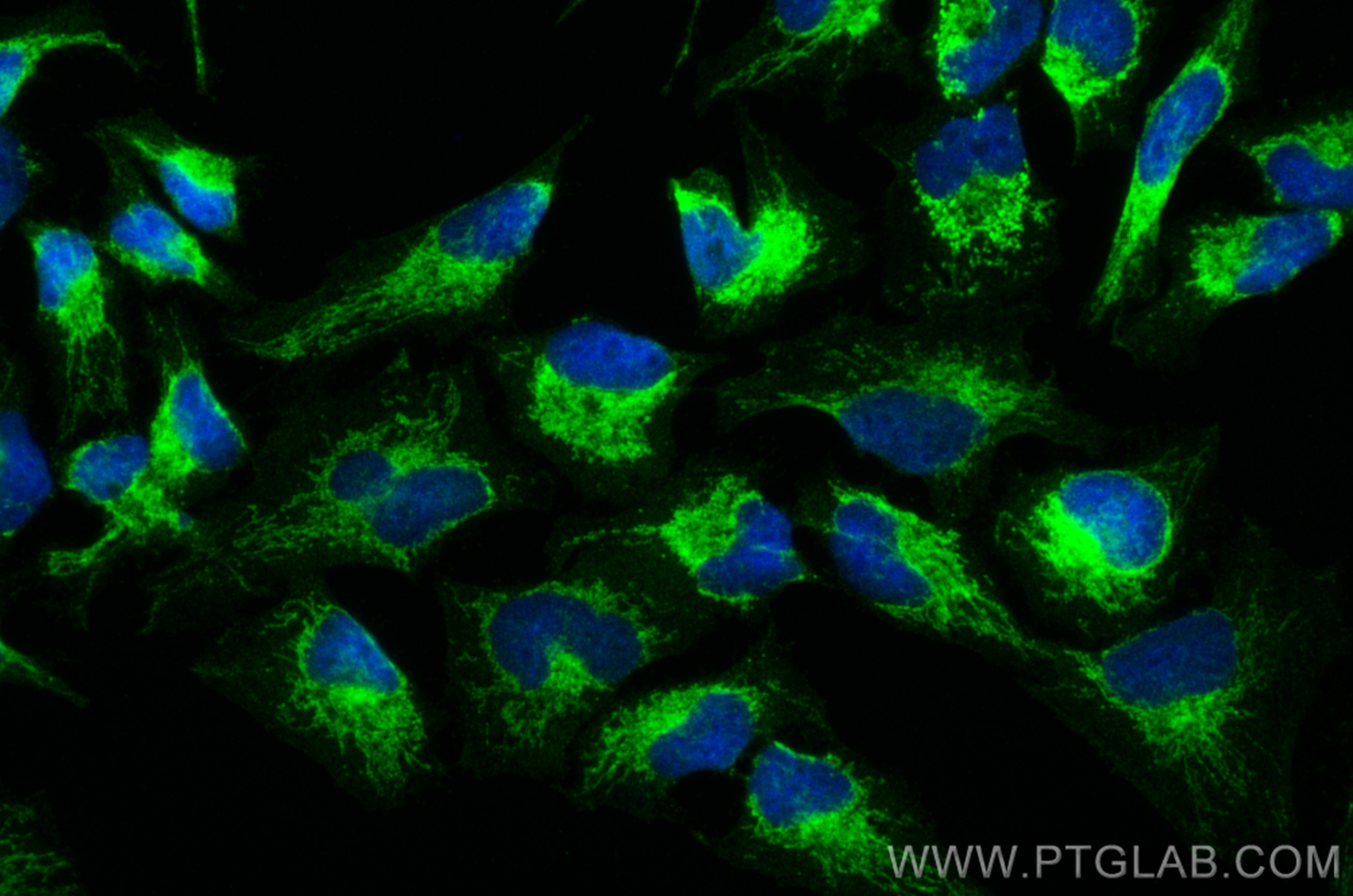 Immunofluorescence (IF) / fluorescent staining of HeLa cells using NNT Polyclonal antibody (13442-2-AP)