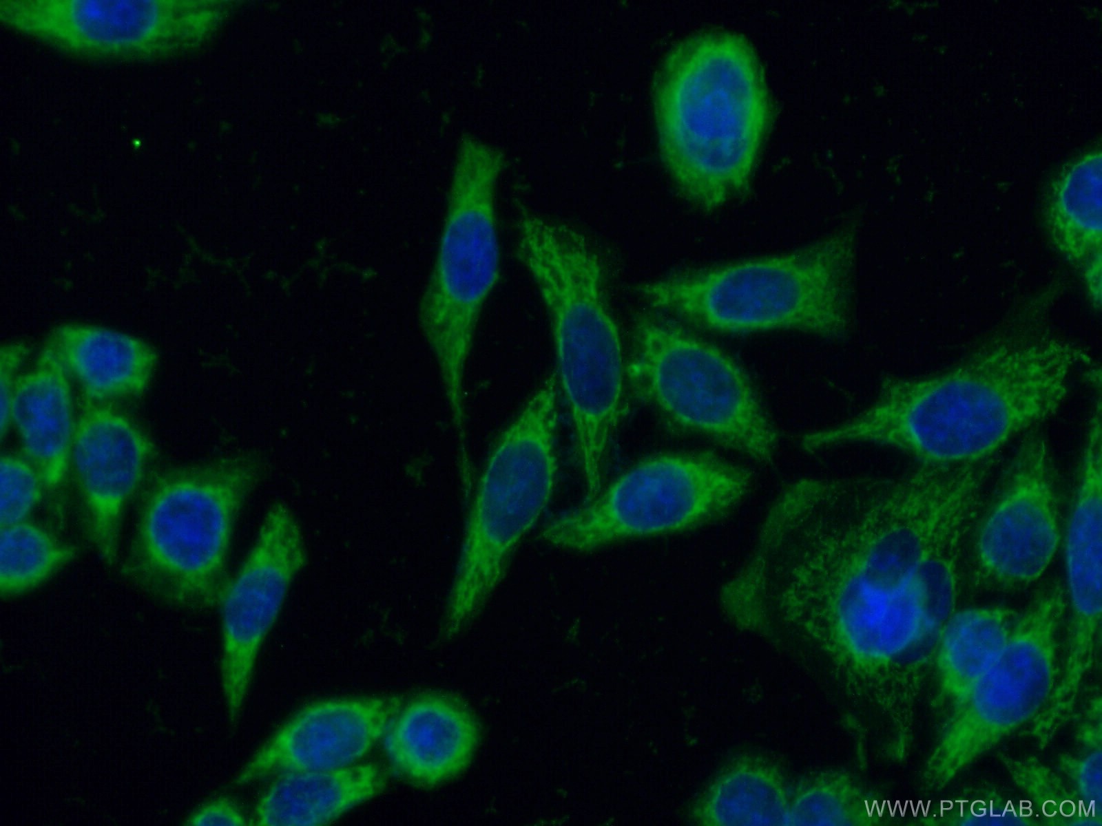 IF Staining of HeLa using 13442-2-AP