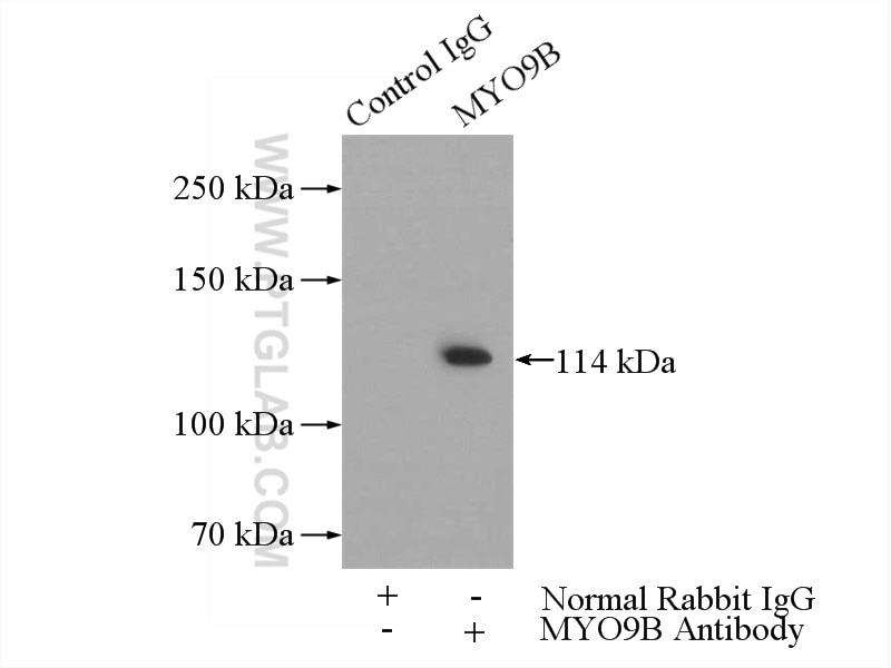 Immunoprecipitation (IP) experiment of HepG2 cells using NNT Polyclonal antibody (13442-2-AP)