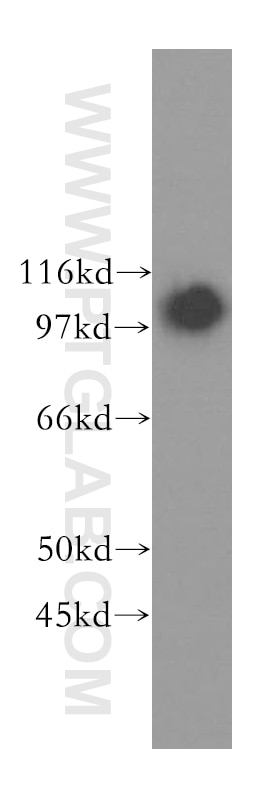 Western Blot (WB) analysis of human adrenal gland tissue using NNT Polyclonal antibody (13442-2-AP)