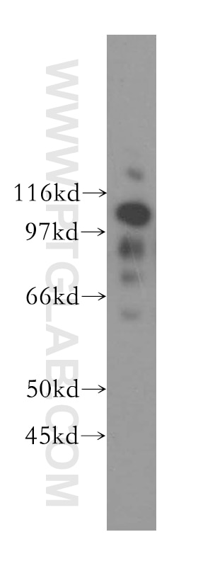 Western Blot (WB) analysis of human liver tissue using NNT Polyclonal antibody (13442-2-AP)