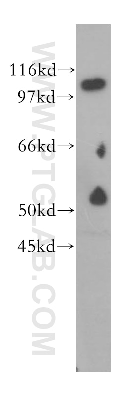 Western Blot (WB) analysis of human adrenal gland tissue using NNT Polyclonal antibody (13442-2-AP)