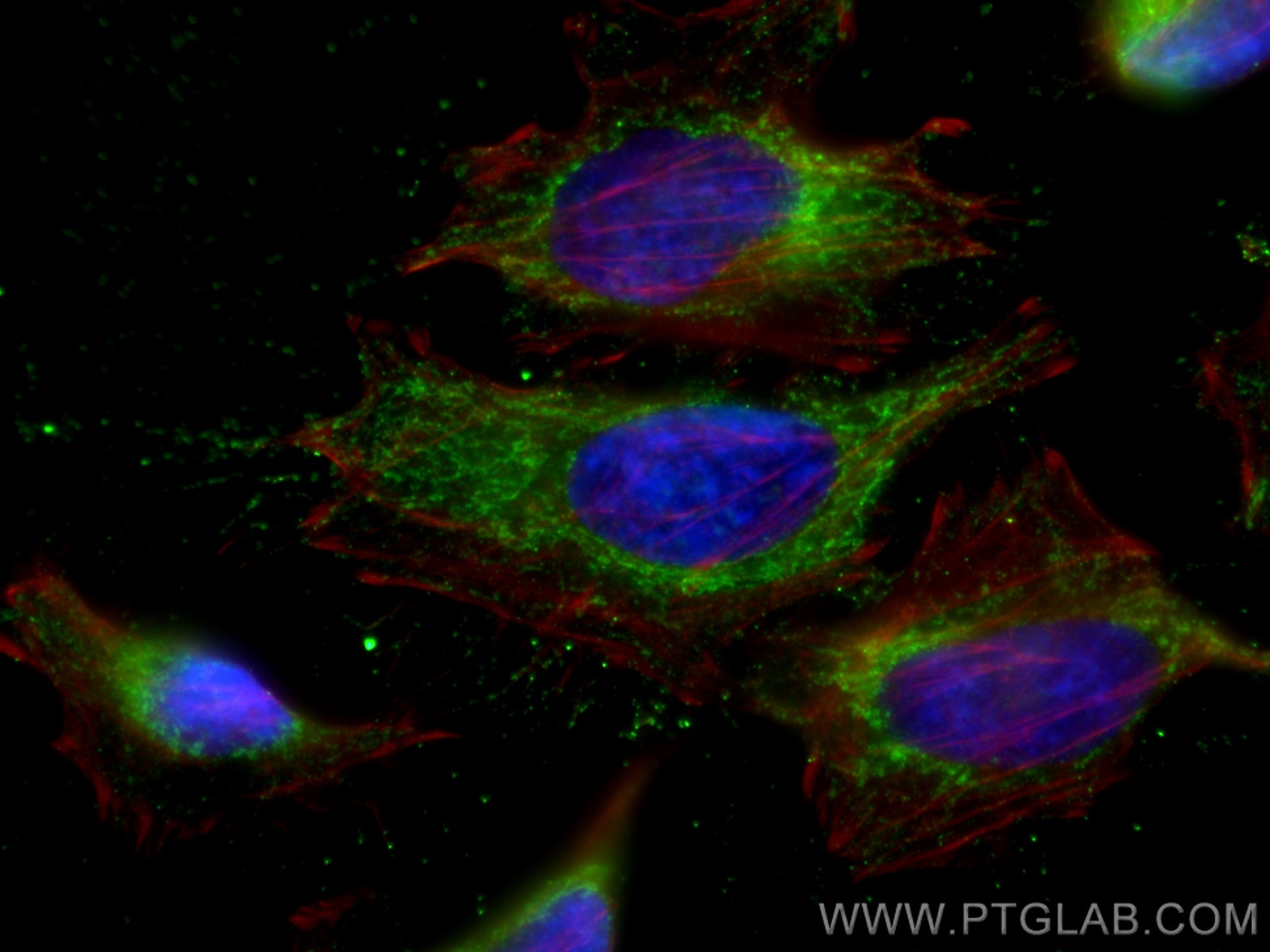 Immunofluorescence (IF) / fluorescent staining of HeLa cells using NNT Monoclonal antibody (68194-1-Ig)
