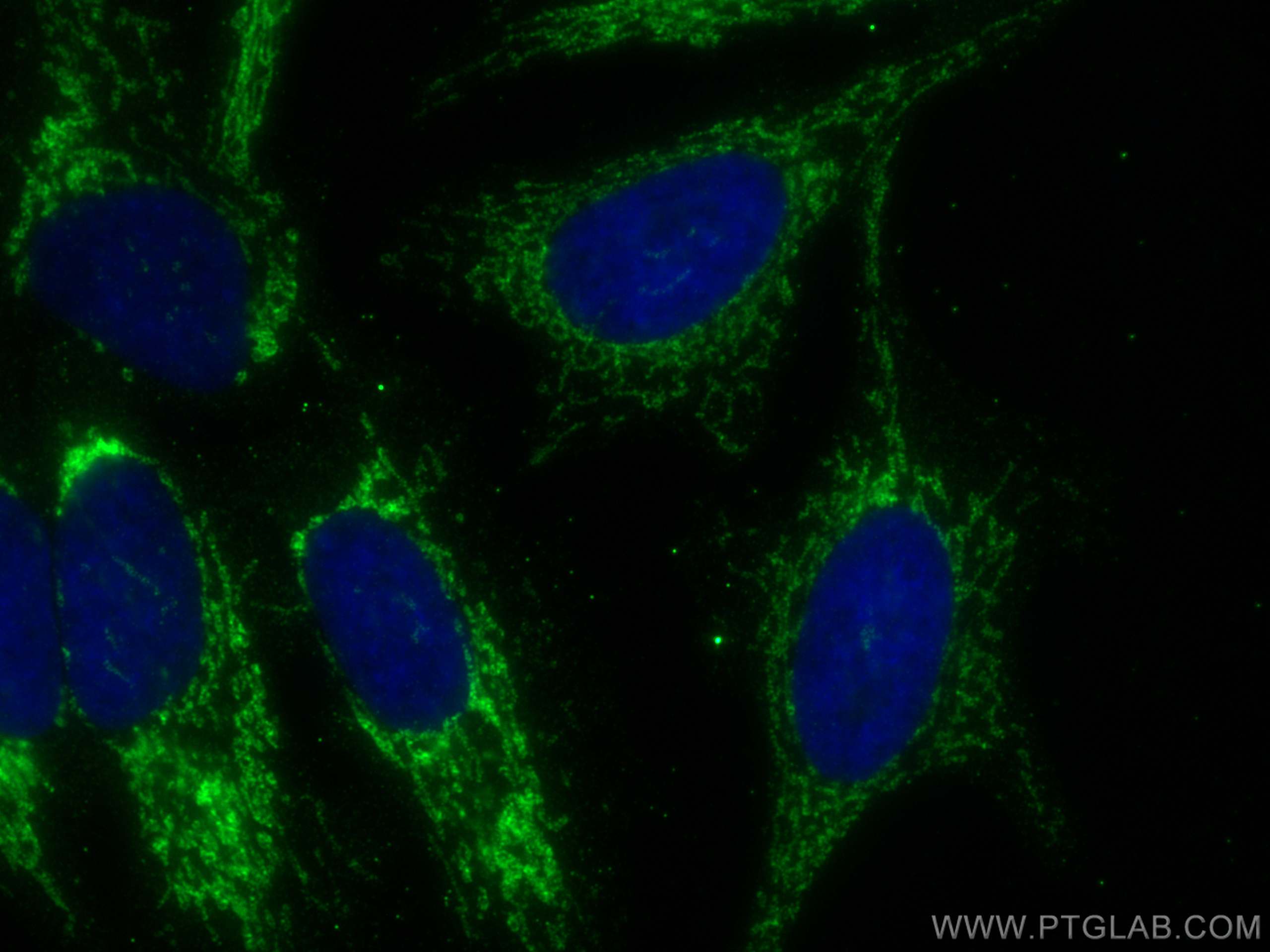 Immunofluorescence (IF) / fluorescent staining of HeLa cells using NNT Monoclonal antibody (68194-1-Ig)