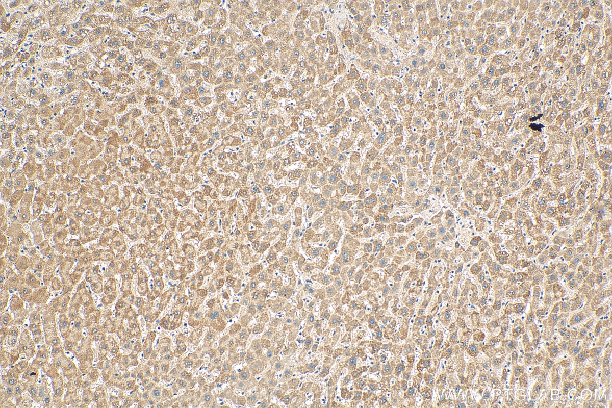 Immunohistochemistry (IHC) staining of human liver tissue using NNT Monoclonal antibody (68194-1-Ig)