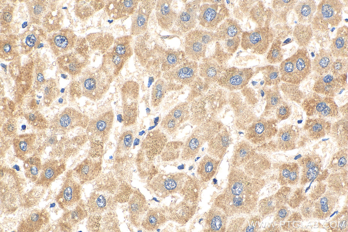 Immunohistochemistry (IHC) staining of human liver tissue using NNT Monoclonal antibody (68194-1-Ig)