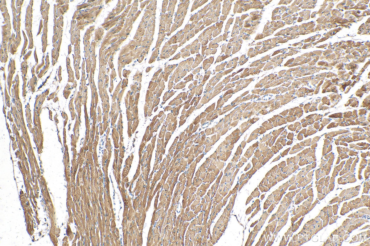 Immunohistochemistry (IHC) staining of mouse heart tissue using NNT Monoclonal antibody (68194-1-Ig)