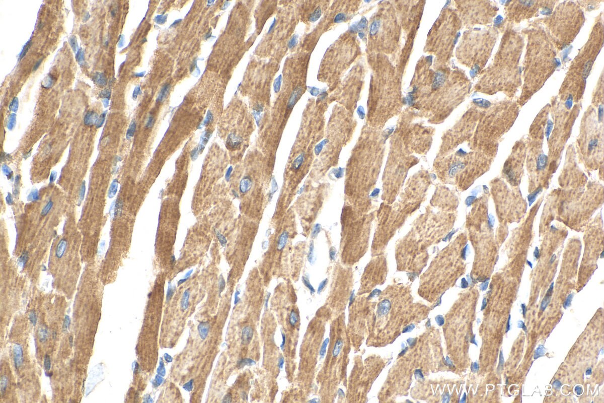 Immunohistochemistry (IHC) staining of mouse heart tissue using NNT Monoclonal antibody (68194-1-Ig)