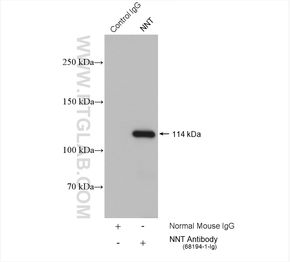 Immunoprecipitation (IP) experiment of HepG2 cells using NNT Monoclonal antibody (68194-1-Ig)