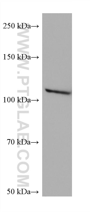 Western Blot (WB) analysis of LNCaP cells using NNT Monoclonal antibody (68194-1-Ig)