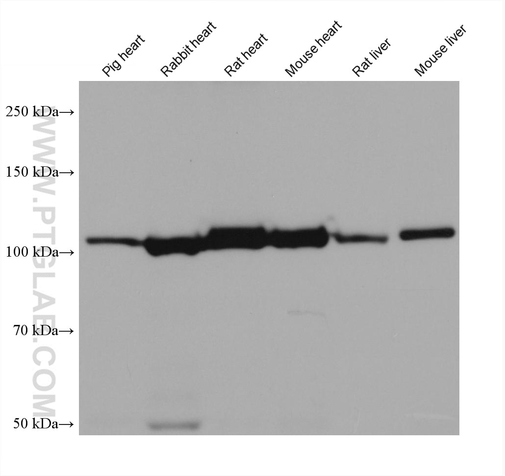 Western Blot (WB) analysis of various lysates using NNT Monoclonal antibody (68194-1-Ig)