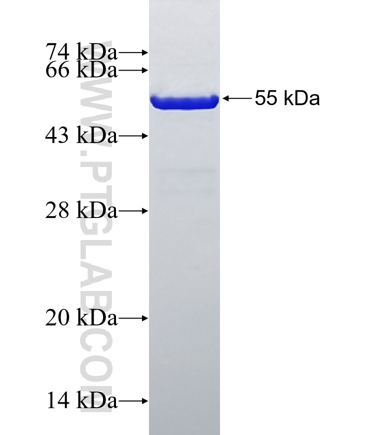 NNT fusion protein Ag4259 SDS-PAGE